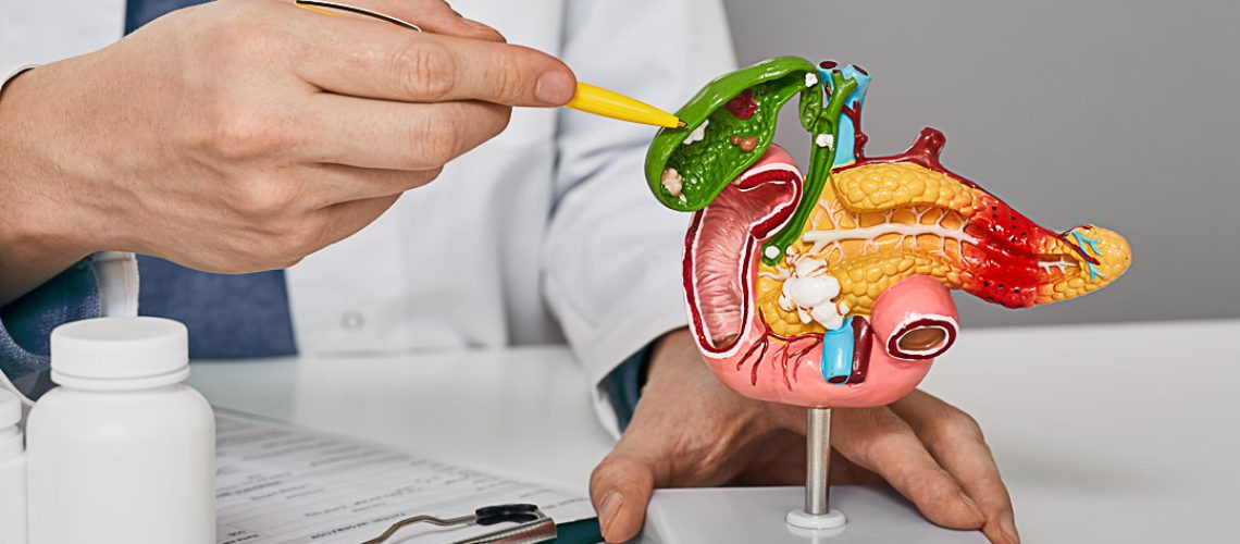 Treatment of gallbladder diseases and cholelithiasis. Doctor demonstrations gallbladder on anatomical medical model for analysing and treatment gallbladder disease