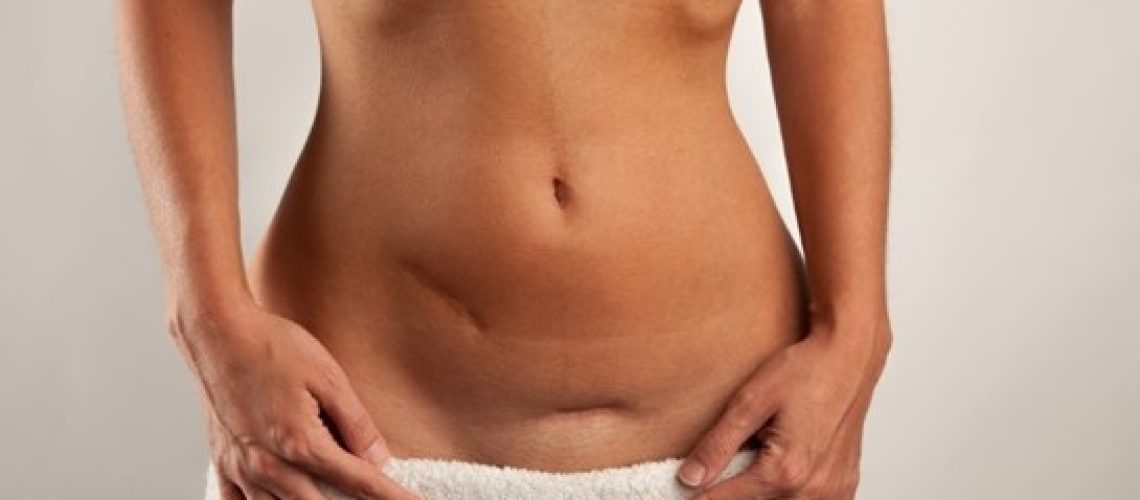 hérnia abdominal