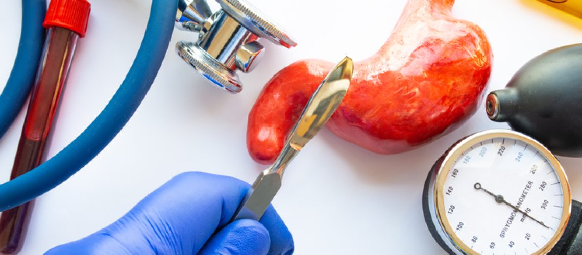 cirurgia bariátrica