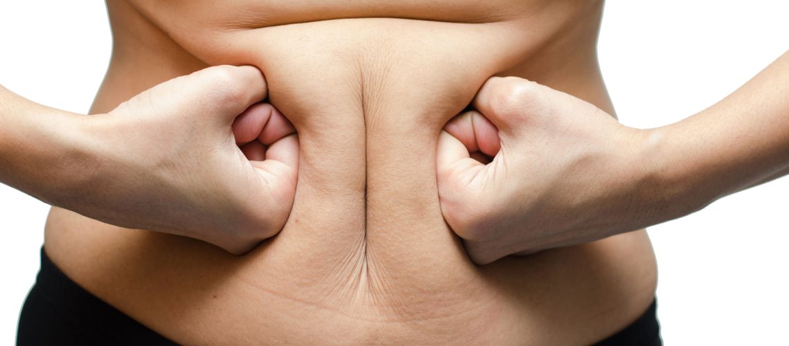 obesidade