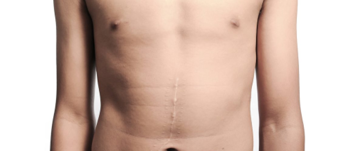 Cirurgia abdominal e hérnias