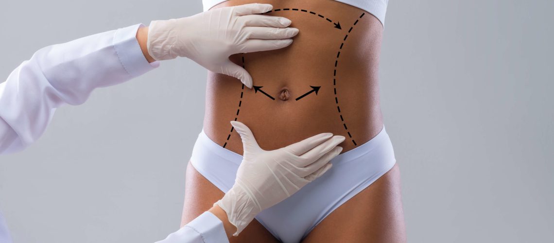 o-que-nao-esperar-da-lipoaspiracao-scaled