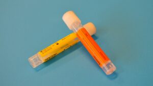 Sangue na Urina: Quando Se Preocupar e Quais Exames Fazer