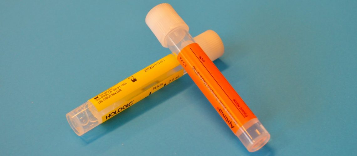 Sangue na Urina: Quando Se Preocupar e Quais Exames Fazer