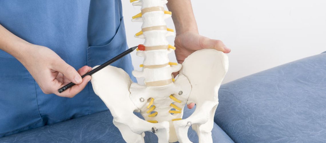 67746430 - doctor with a pen showing a hernia in a skeleton to a patient.