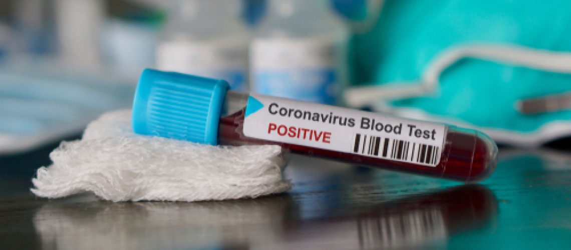 Coronavirus